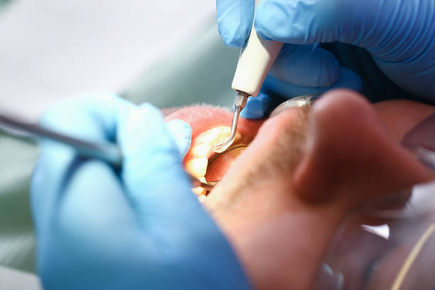 Best Emergency Treatment for Toothache in Ardia, CA
